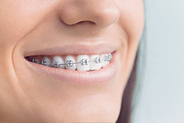 Best Full Mouth Reconstruction  in Berthoud, CO